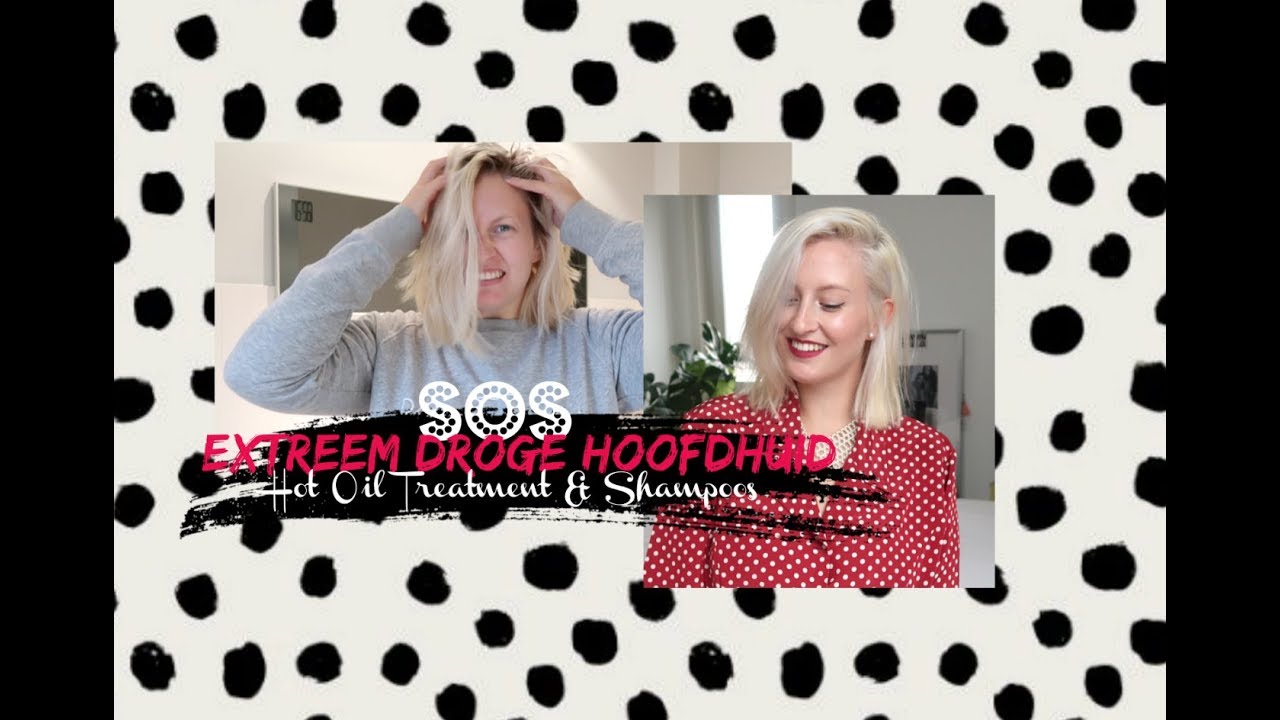 HOT OIL TREATMENT & SHOWER ROUTINE - Tips voor een jeukende en droge hoofdhuid // Coeur Belgique