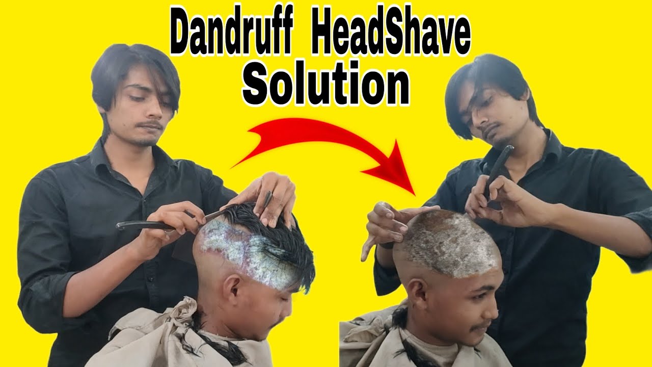HeadShave,dandruff(Homeless,Elegant The most attractive dandruff remove,shampoo,solutionTutorial2025