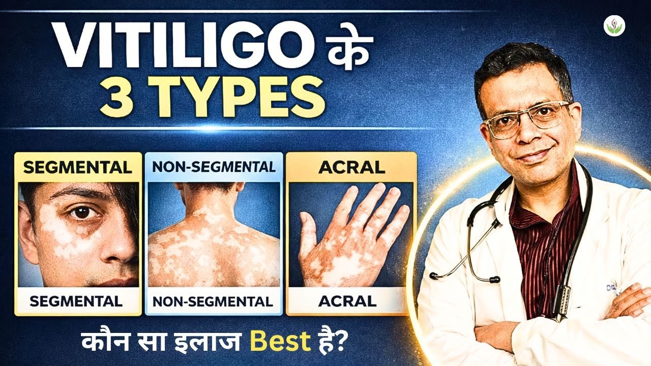 Vitiligo के 3 Types | कौन सा Treatment Best है? | Segmental vs Non-Segmental vs Acral