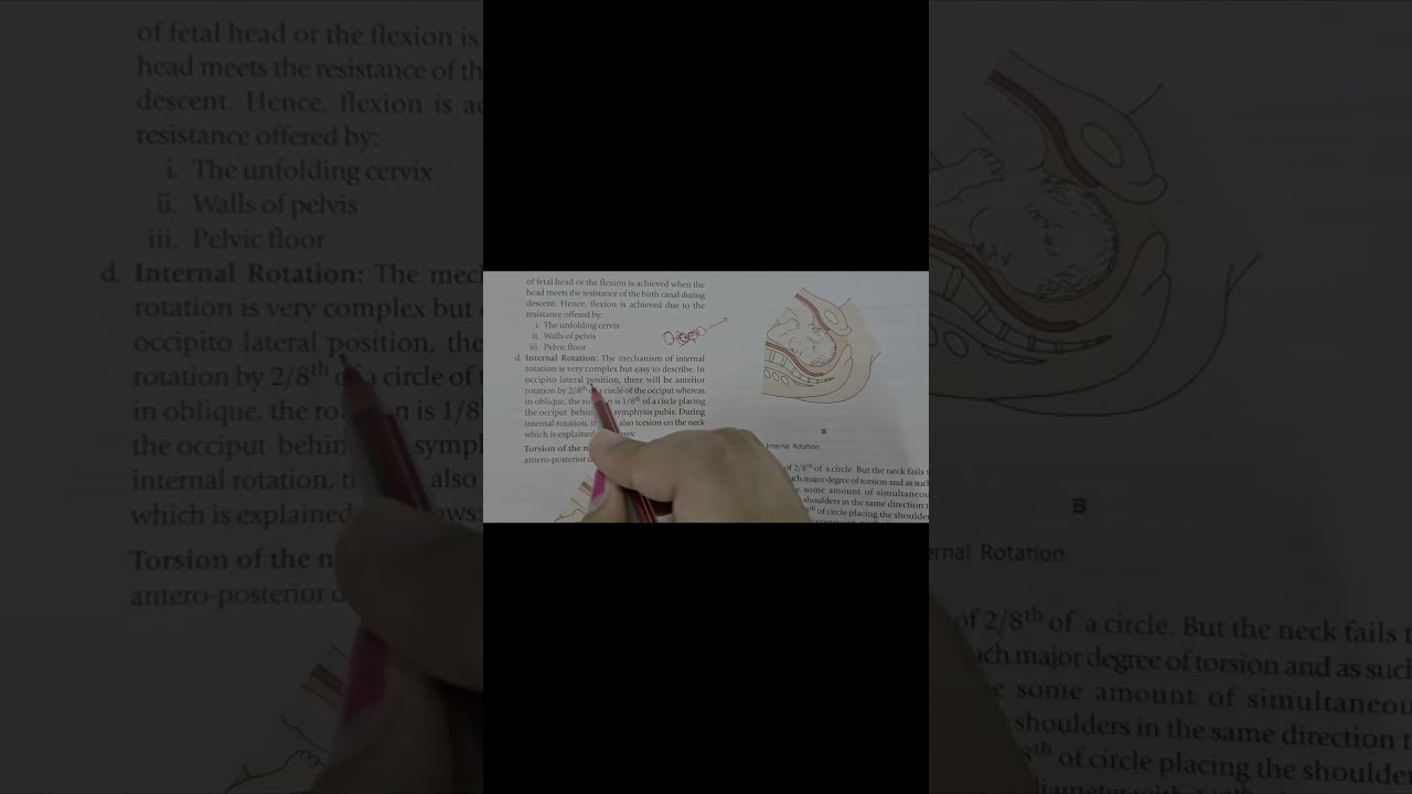 Mechanism of Labor : Internal Rotation