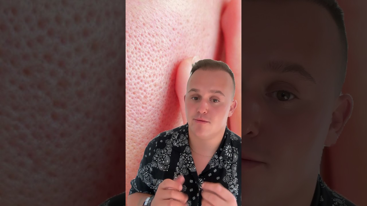 Rozszerzone pory? MAM NA TO SPOSÓB! 