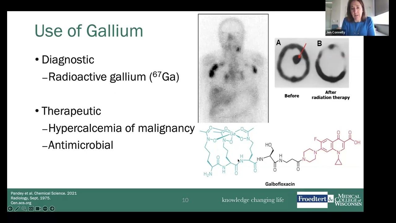 Society of Neuro Oncology Sub-Saharan Africa (SNOSSA) IQAI Ph 1 Trial Update 110223