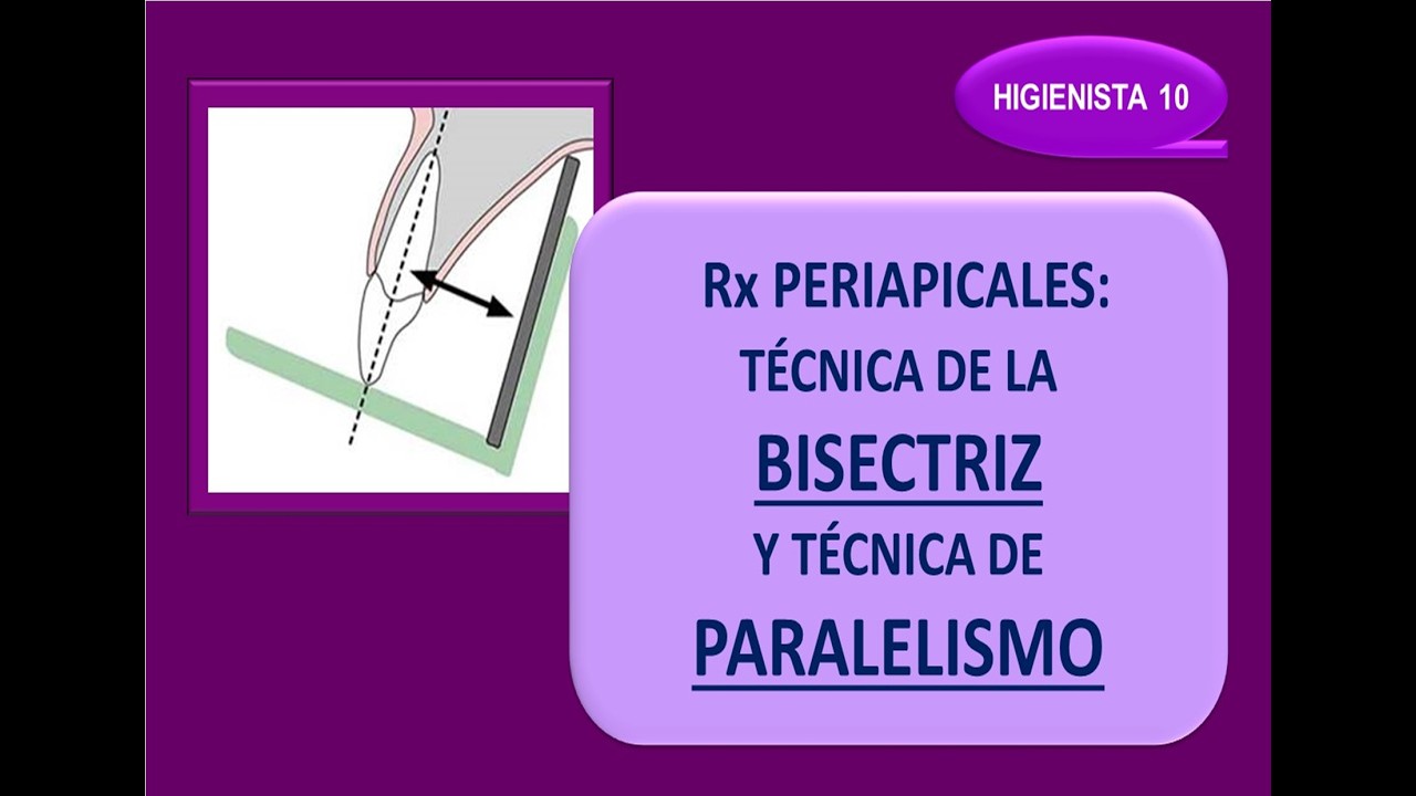 BISECTRIZ y PARALELISMO: cómo hacer una PERIAPICAL.