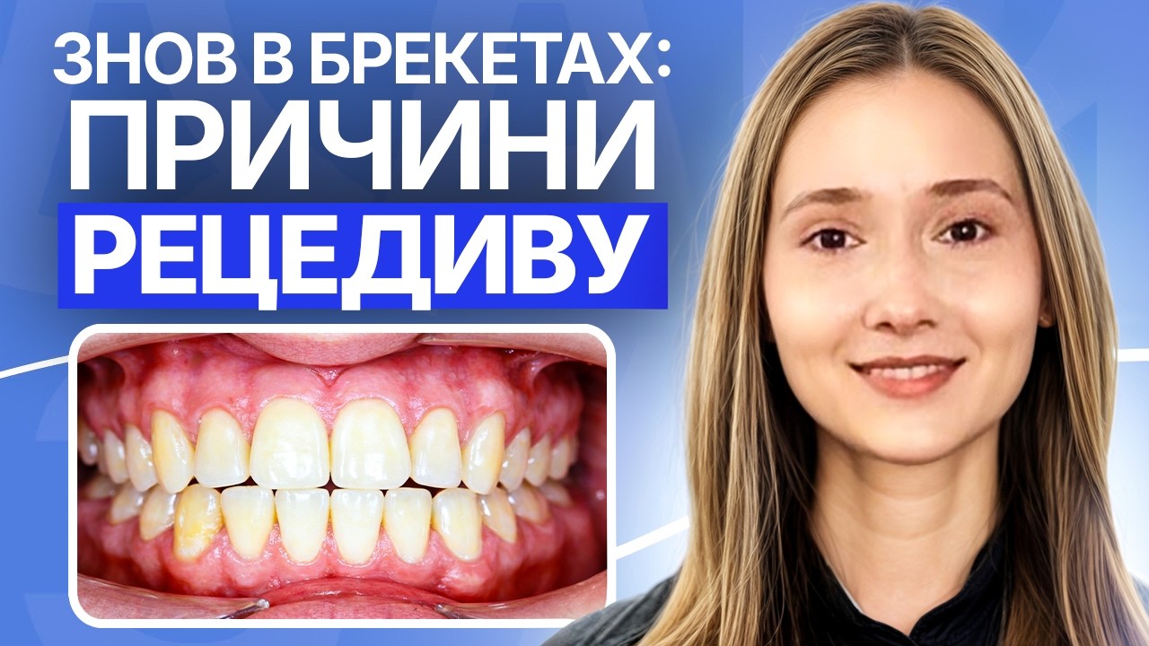 Повторне ортодонтичне лікування відкритого прикусу