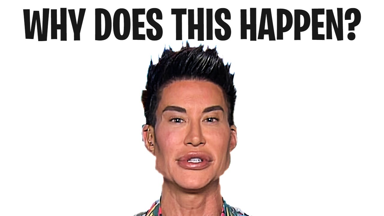 Why Do People Look Worse After Plastic Surgery?