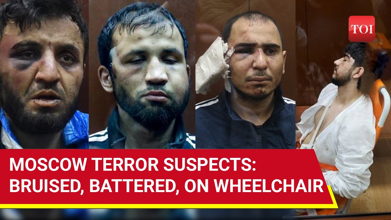 Putin’s Men Tortured Moscow Terror Suspects? Courtroom Images Viral