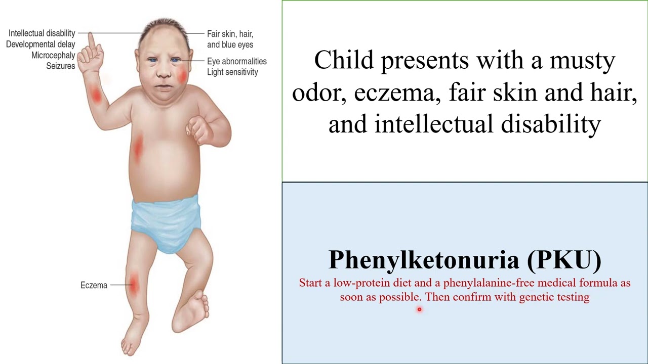 Metabolic Disorders Last-Minute Flash Cards Preview