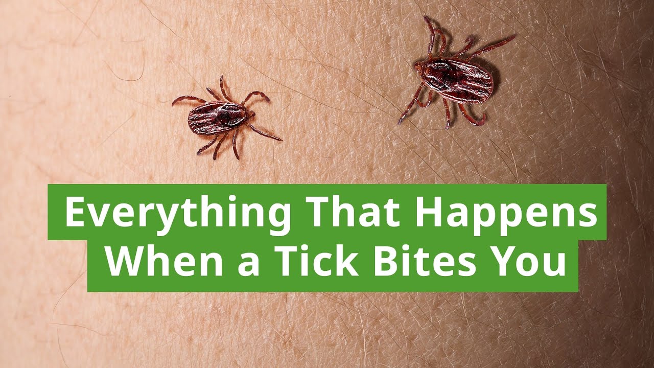 How Ticks Spread Disease: The Hidden Process of Transmission