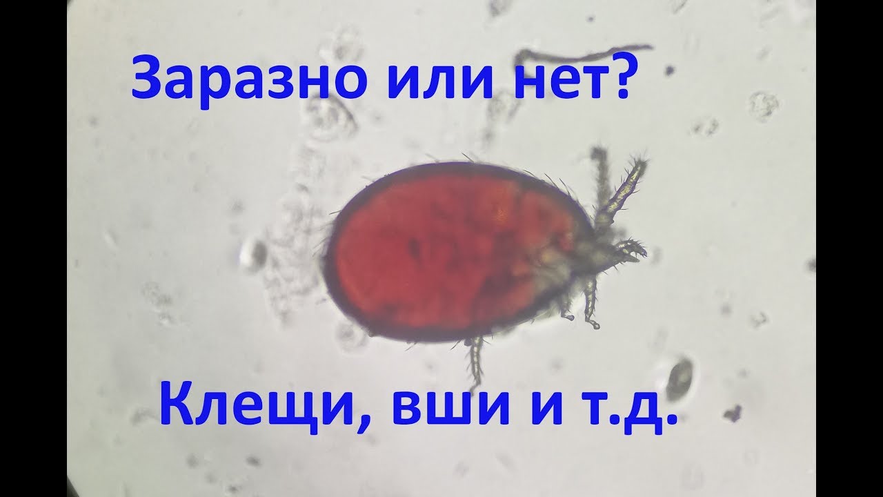 Заразно ли это и как с этим бороться?