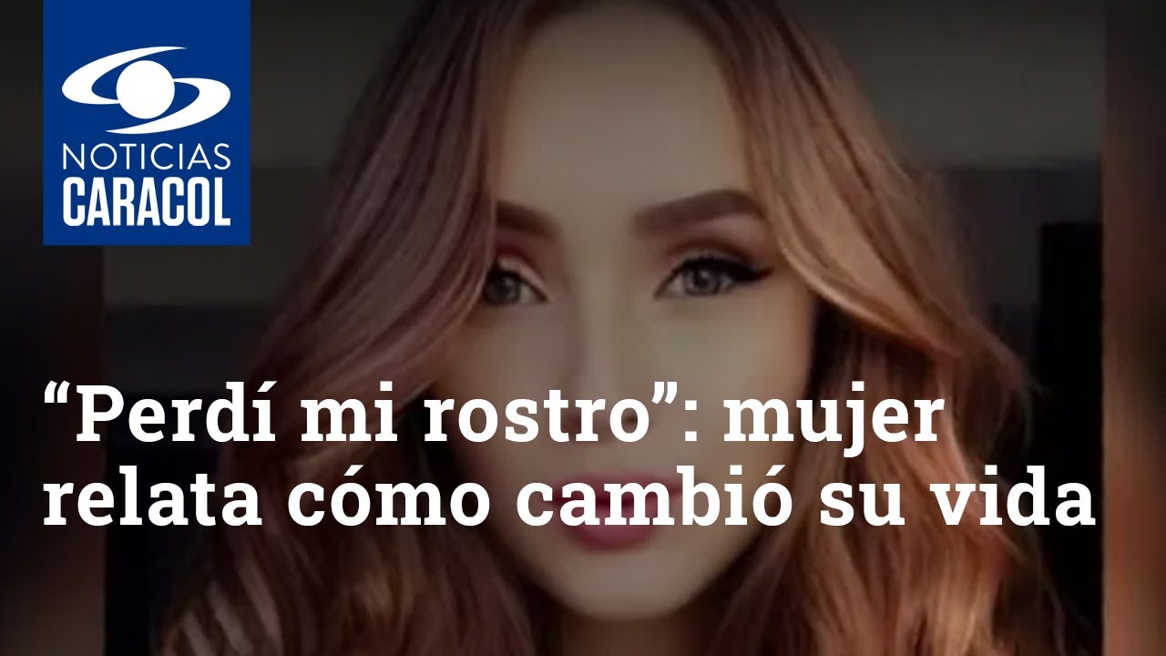 “Perdí mi rostro”: mujer relata cómo cambió su vida tras ser víctima de un ataque con ácido