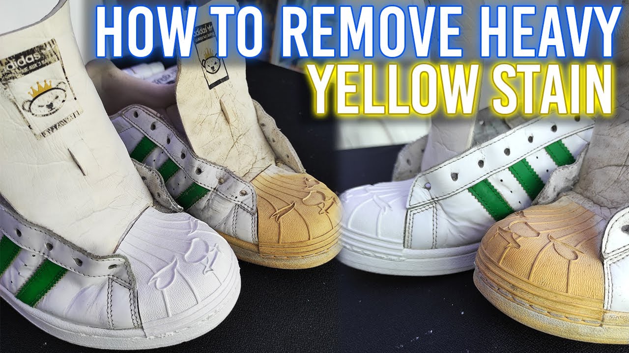 ADIDAS SUPERSTAR NIGO BEARFOOT WHITE/GREEN | REMOVE YELLOW STAIN