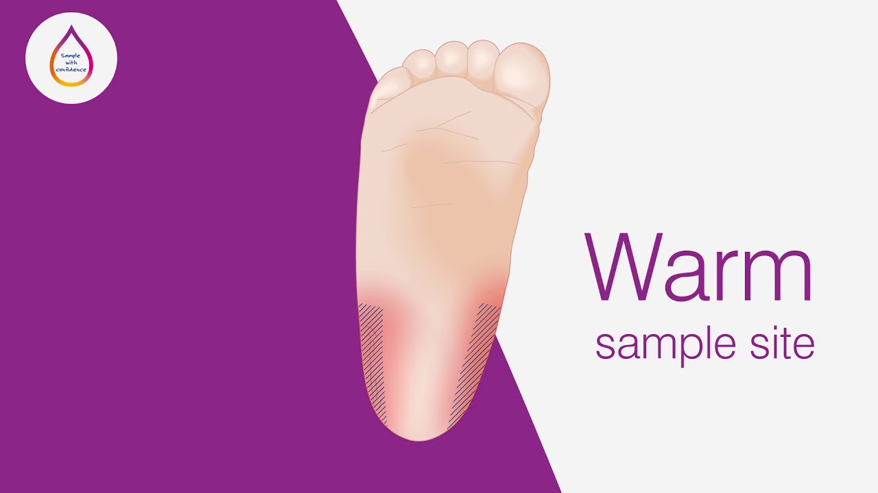 Heel sampling best practice (complete video - English)