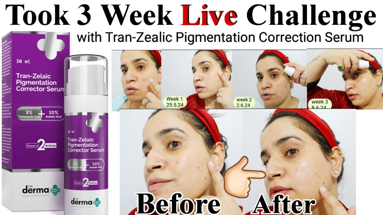 Derma co Tran zealic Pigmentation corrector Serum Review