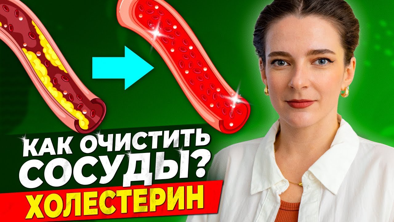 КАК СНИЗИТЬ ХОЛЕСТЕРИН? Как очистить сосуды от холестерина? Плохой и хороший холестерин (ЛПНП/ЛПВП)