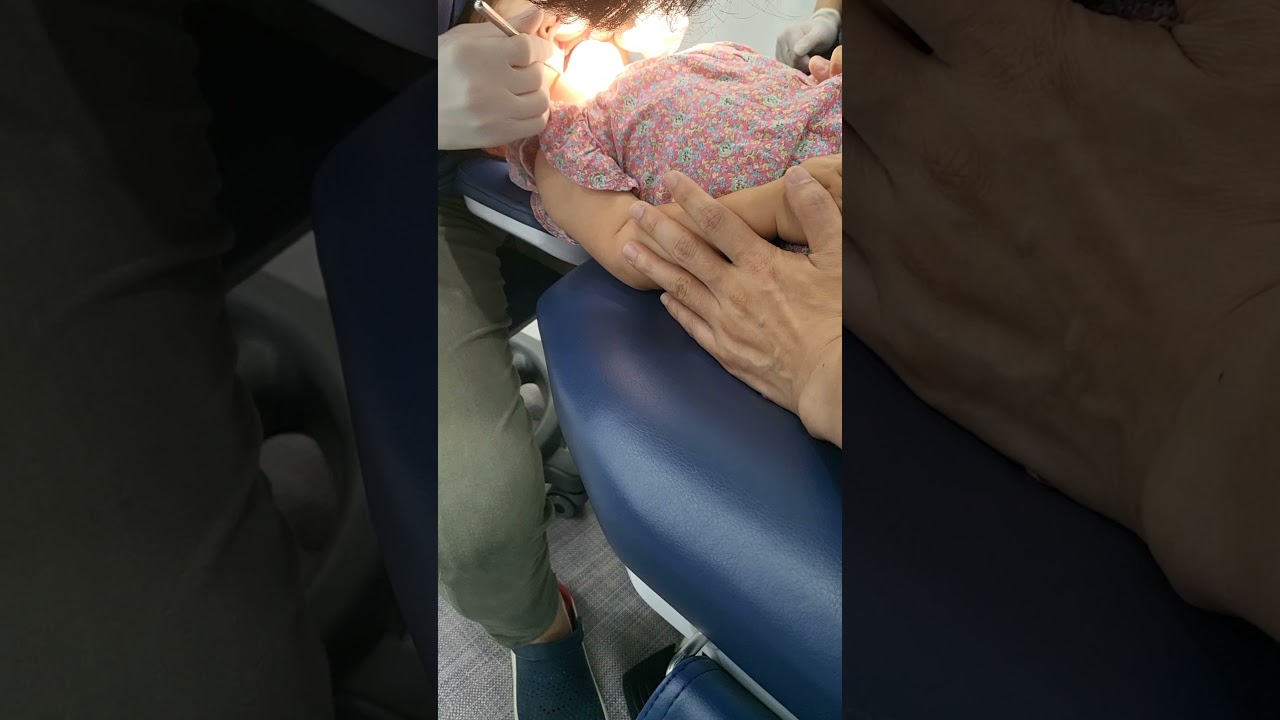 22개월 아기 치과치료 처음 받은 날