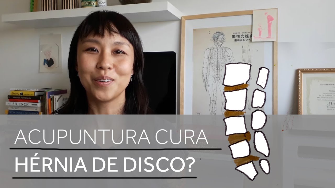 A acupuntura cura hérnia de disco?