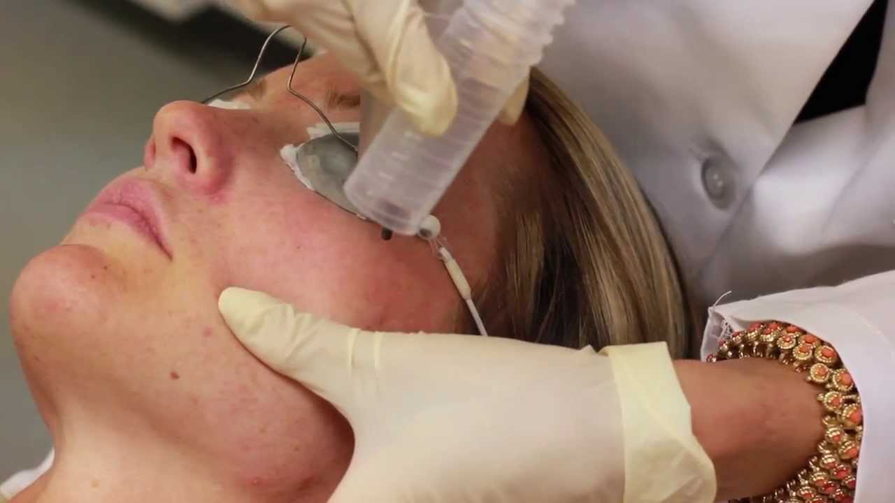 MedLite Laser Demonstration