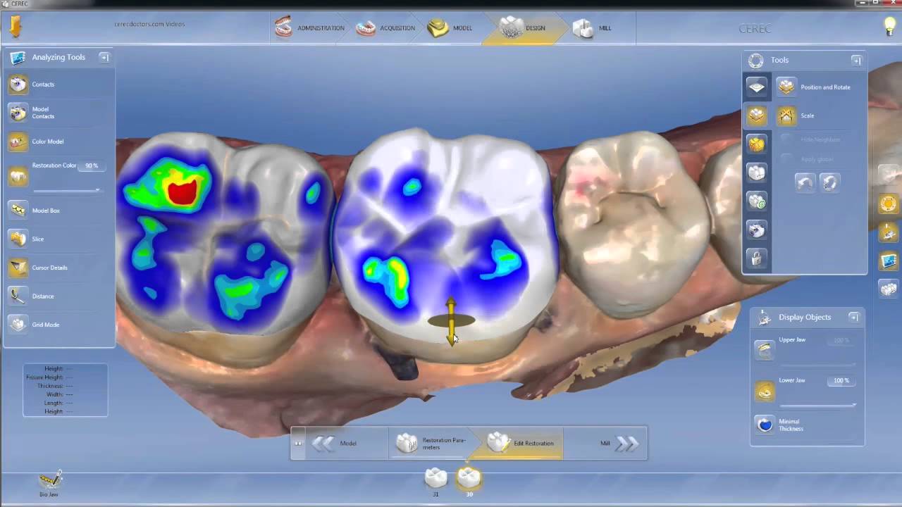 Exploring CEREC SW 4.4: Tutorial 5 - Design Phase