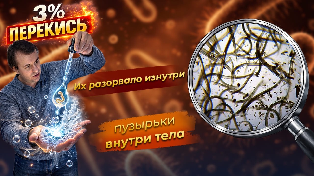 Что сделает 3% перекись с нематодами? Реальный эксперимент под микроскопом