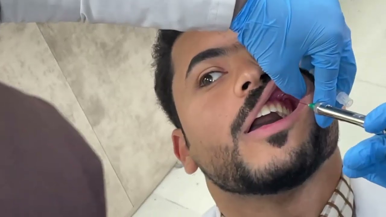 جراحة | Infiltration technique (جزء اول )