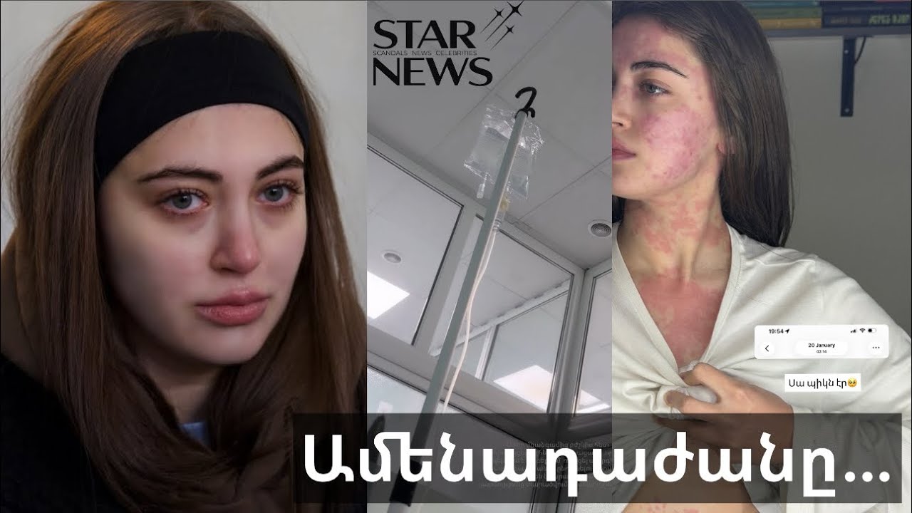 Իմ հետ եղավ մի բան, որի լուծումը չկար… Ի՞նչ է պատահել Մերի Քոչարյանին. Բացառիկ մանրամասներ