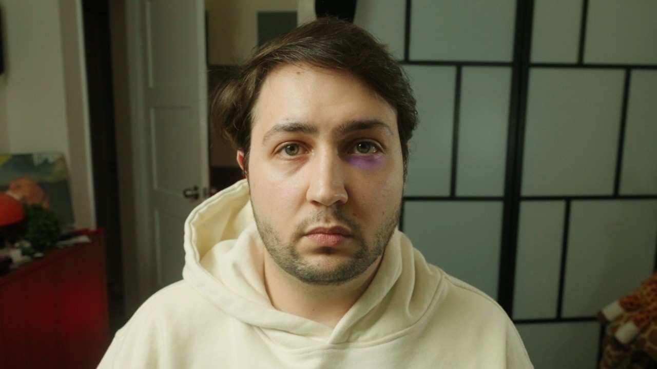 I got into a Car Accident.
