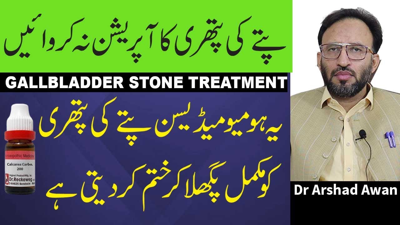 How To Treat Gallbladder Stones Permanently In Urdu