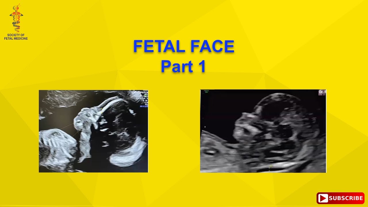 Fetal Face Part 1