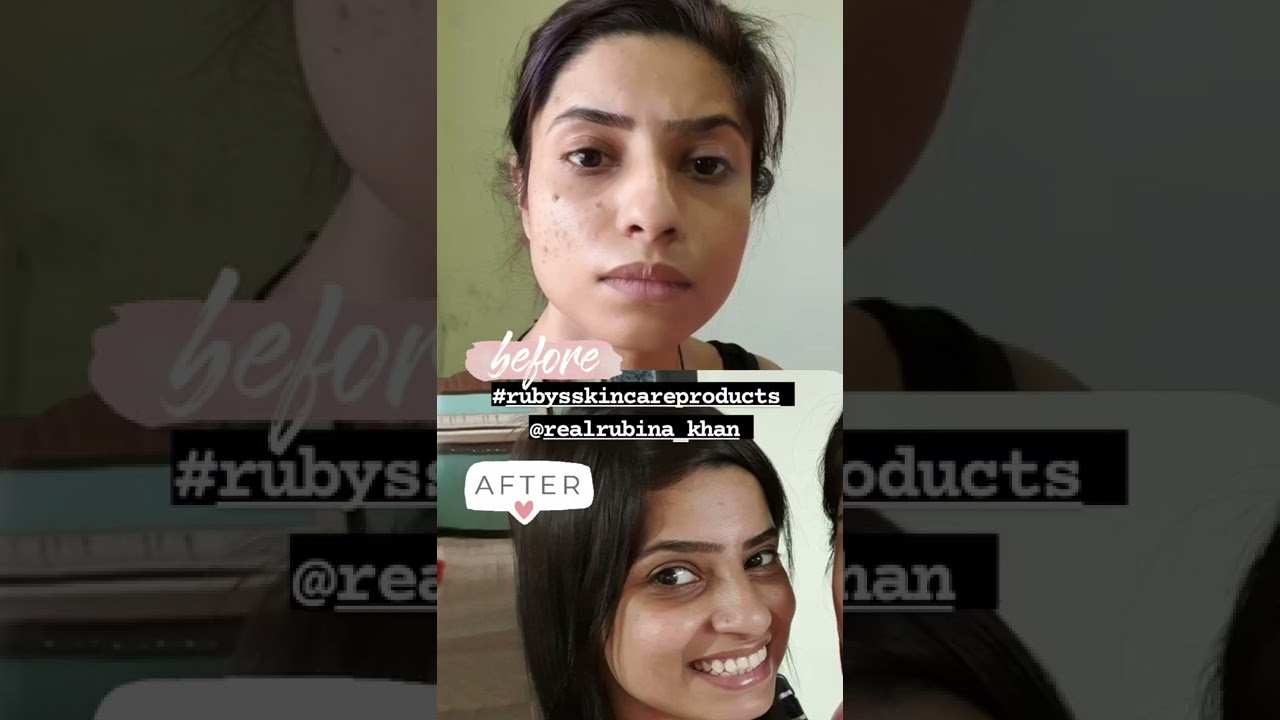 Ruby's skin care products