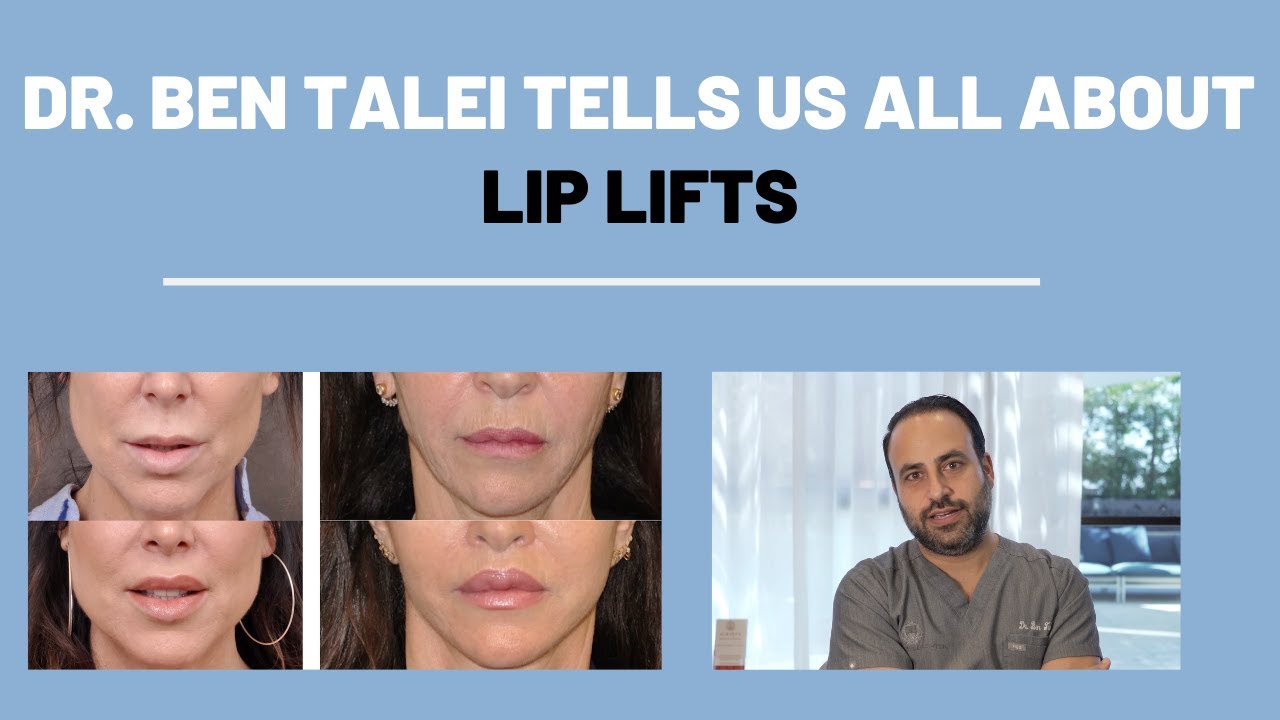 Lip Lift Q and A with Plastic Surgeon, Dr. Ben Talei