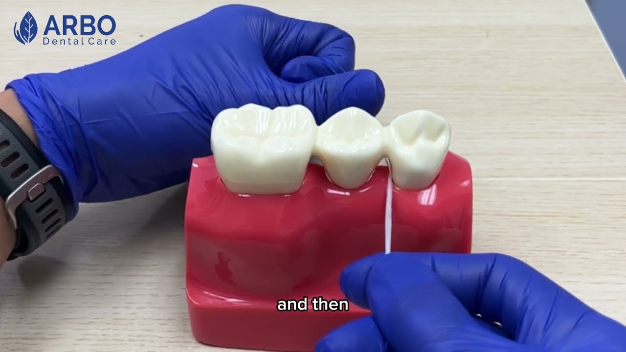How to floss dental bridge? | Arbo Dental Care