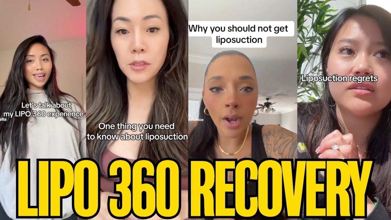 The Brutal Reality of Lipo 360 Recovery Nobody Talks About