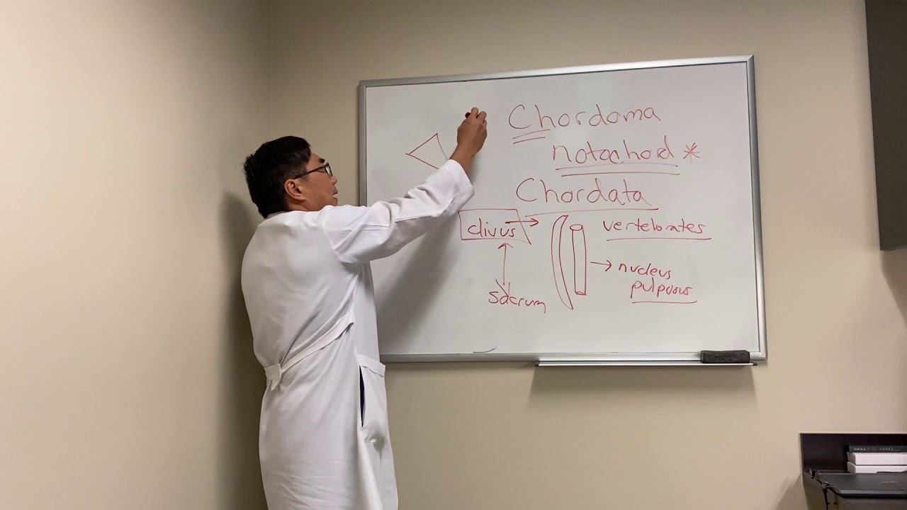 Chordoma