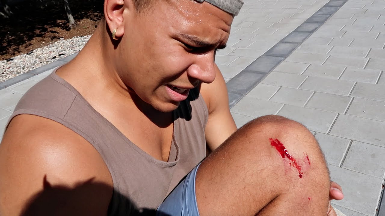 SUPER BAD IDEA!! CUT MY KNEE OPEN!