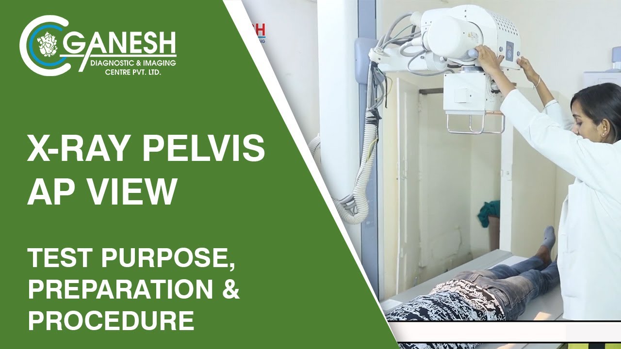X-Ray Pelvis AP View - Test Purpose, Preparation & Procedure | Ganesh Diagnostic
