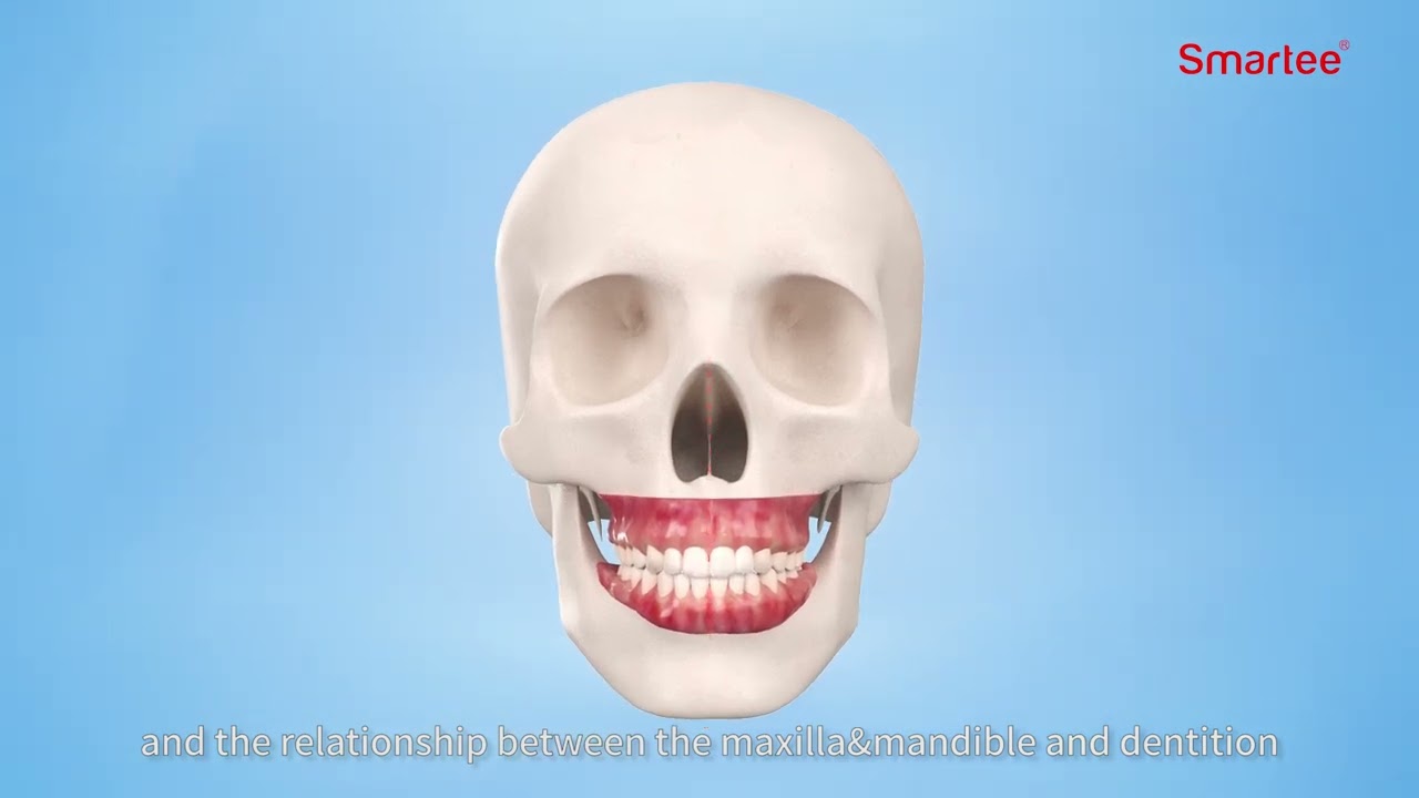 Smartee S17 --- Smartee Active Mandibular Repositioning Retention Protocol