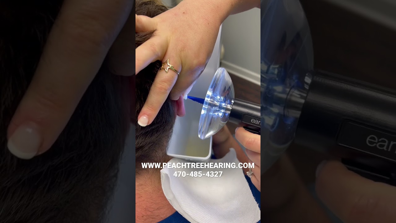 Always gentle earwax removal! #earigator #earwaxremoval #audiology #extractionsatisfaction #ears
