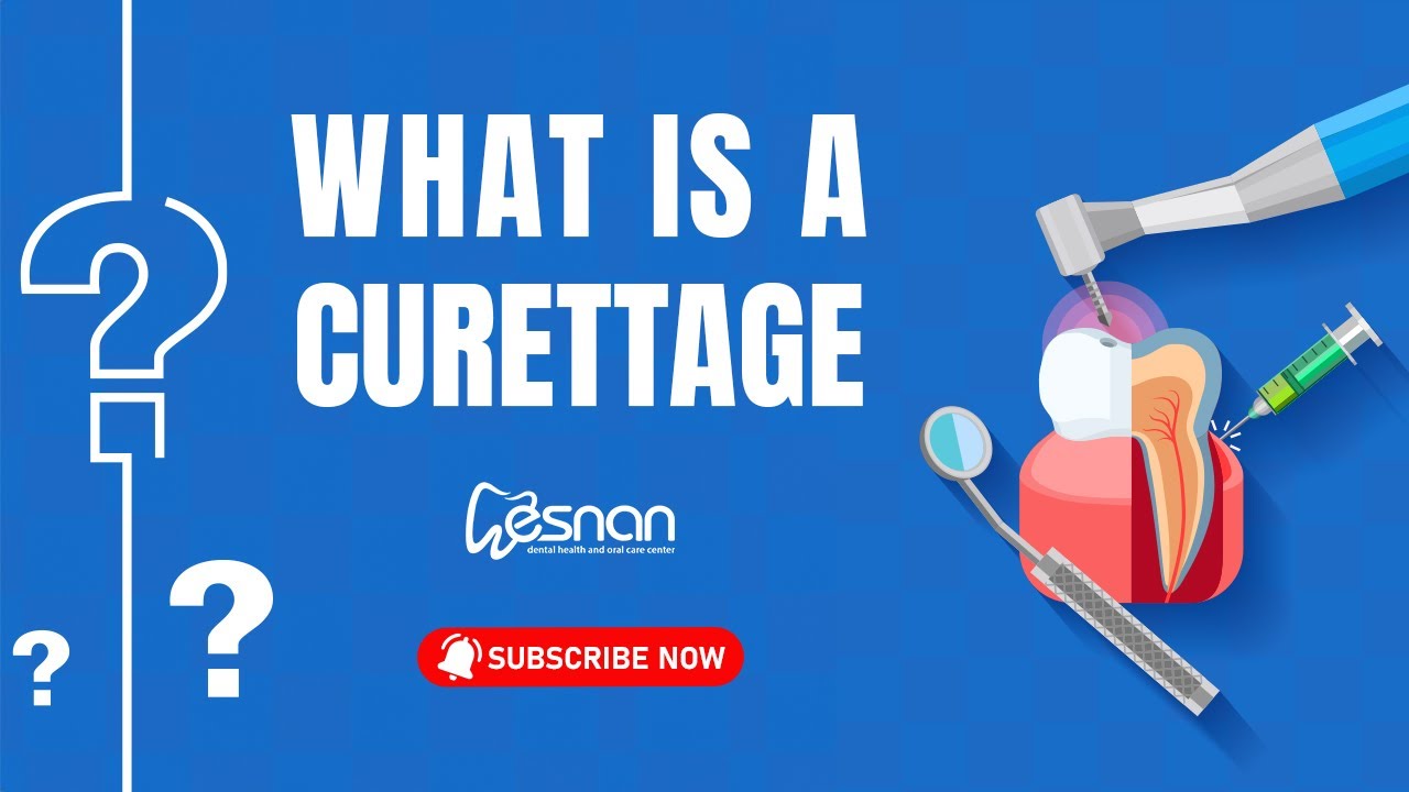 Процедура поддесневого кюретажа стоматологического пациента | Стоматологическая клиника Эснан
