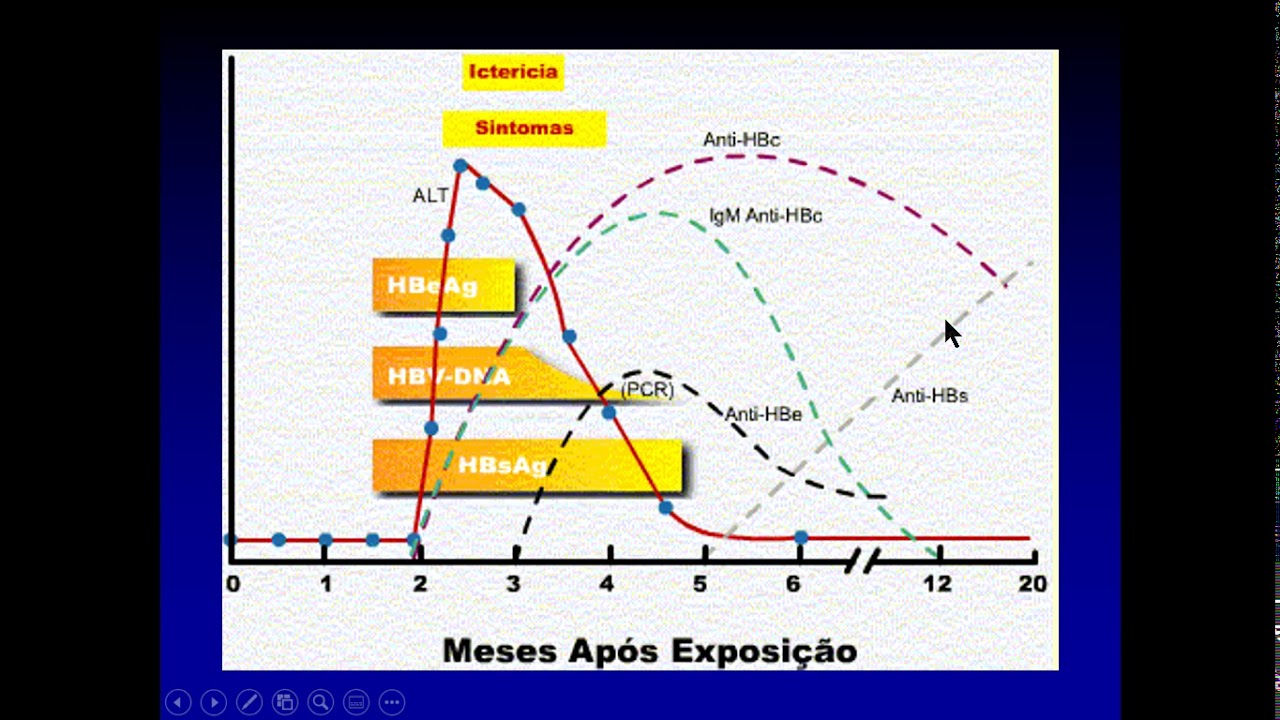 Diagnóstico Hepatitie B   parte 03