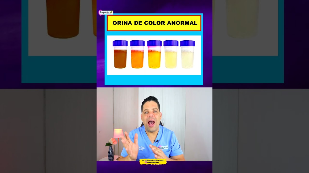 PRIMEROS SINTOMAS DE RI&Ntilde;ONES ENFERMOS  #noticias