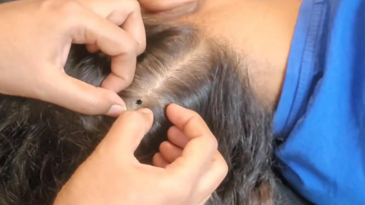 Scalp Check ASMR - The Most Relaxing Tingle Experience