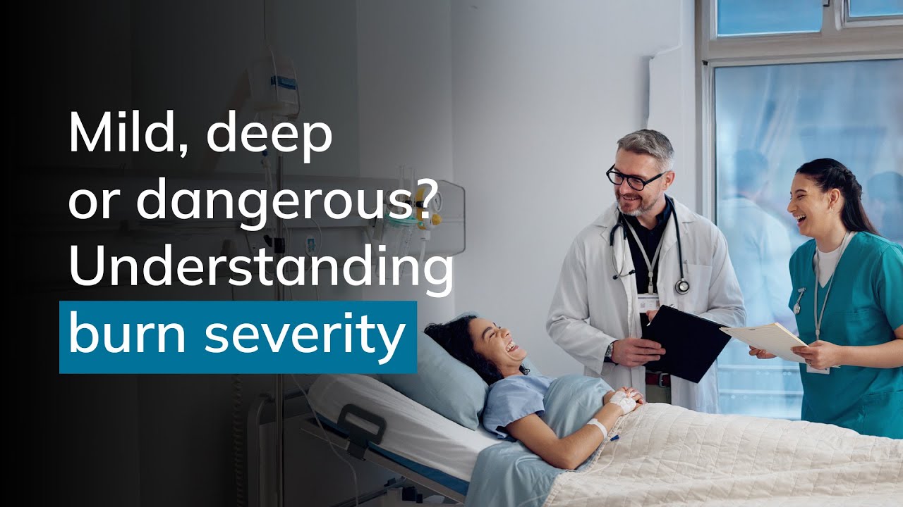 Burn Injury Severity Assessment | Dr Selva Seetharaman | Gleneagles Hospital, Chennai