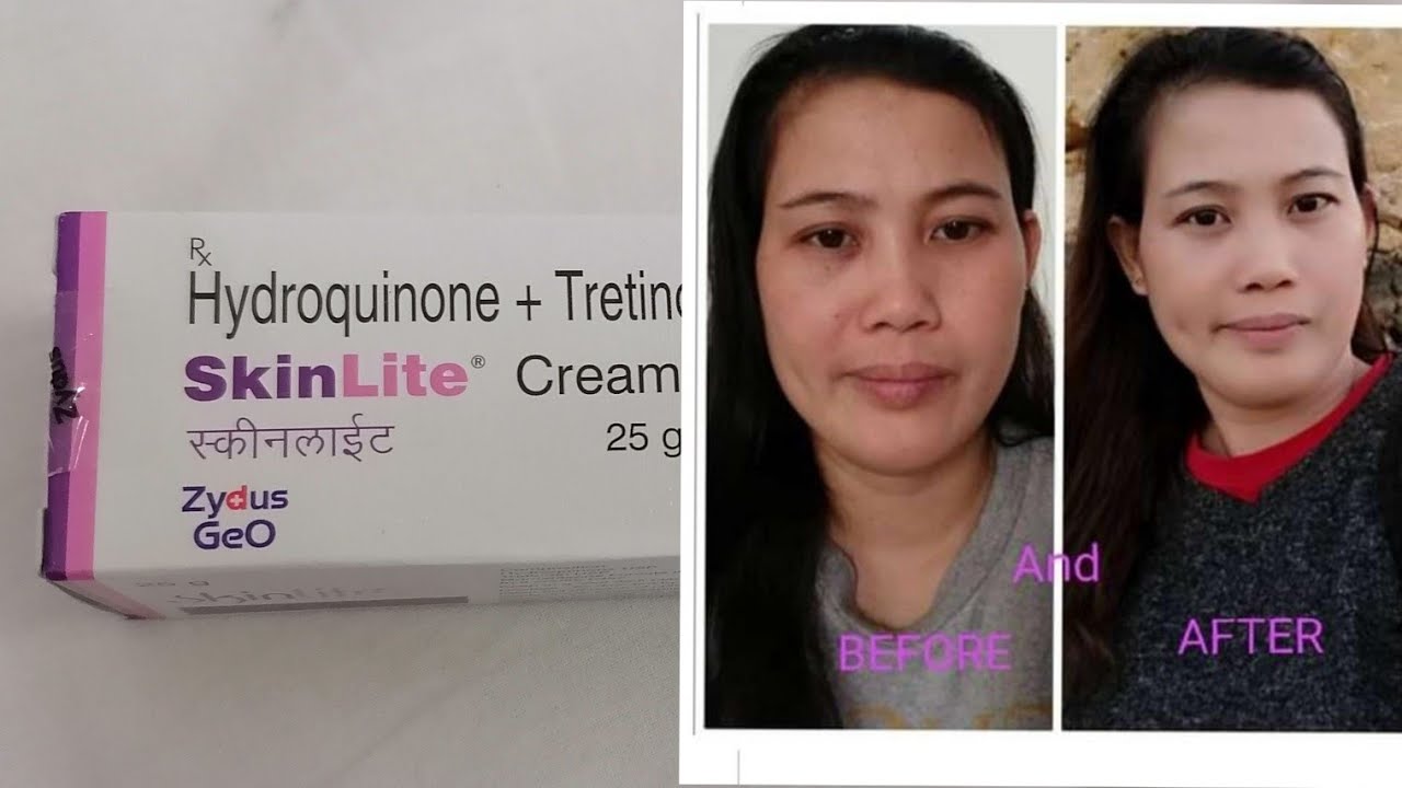 Hanap moba ay papaganda SKINLITE CREAM,