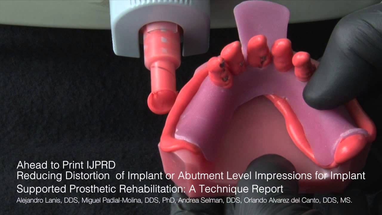 Tecnica de Impresion Implantes Dentales IJPRD
