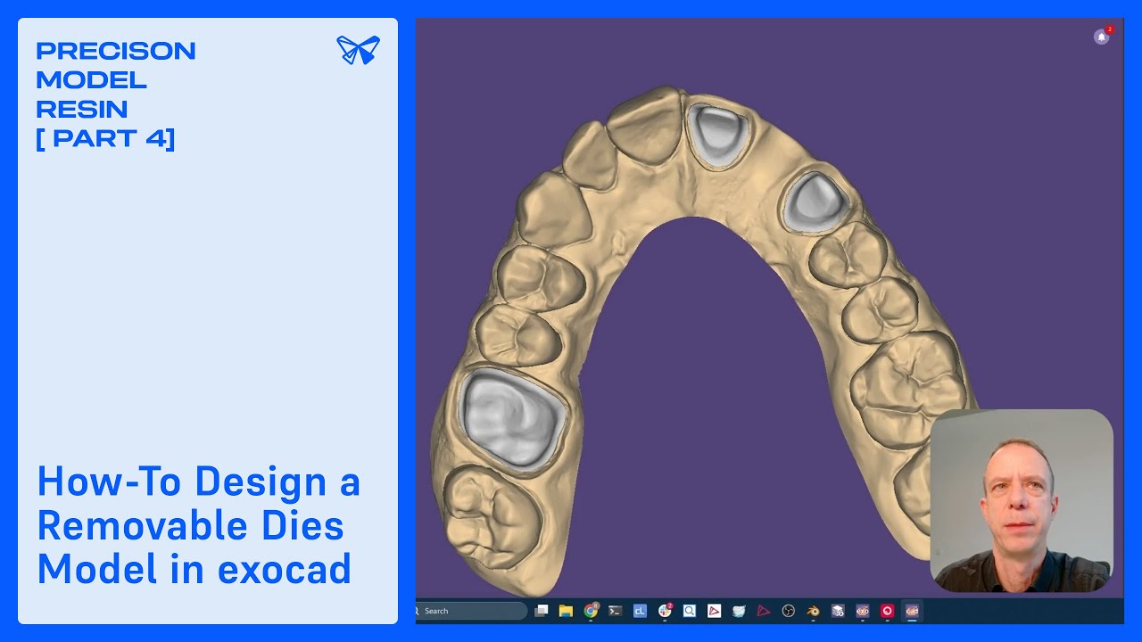 How-To Design a Removable Dies Model in exocad© | Precision Model Resin [Part 4]