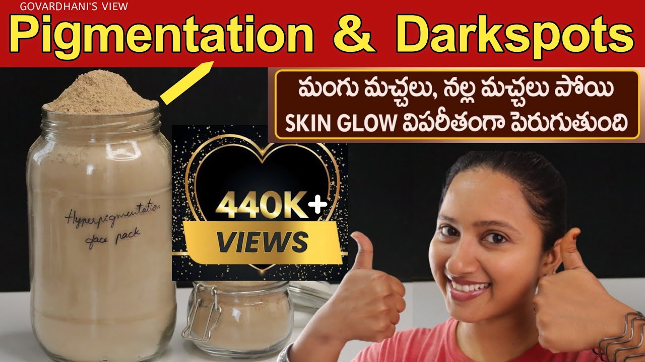 Pigmentation treatment on face at home in Telugu | Melasma, Dark Spots & Acne Spots  Govardhani