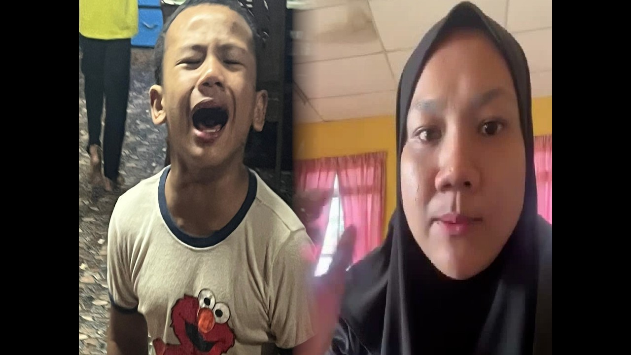 Anak usia setahun dah tumbuh bulu kemaluan, ibu dedah perubahan luar biasa