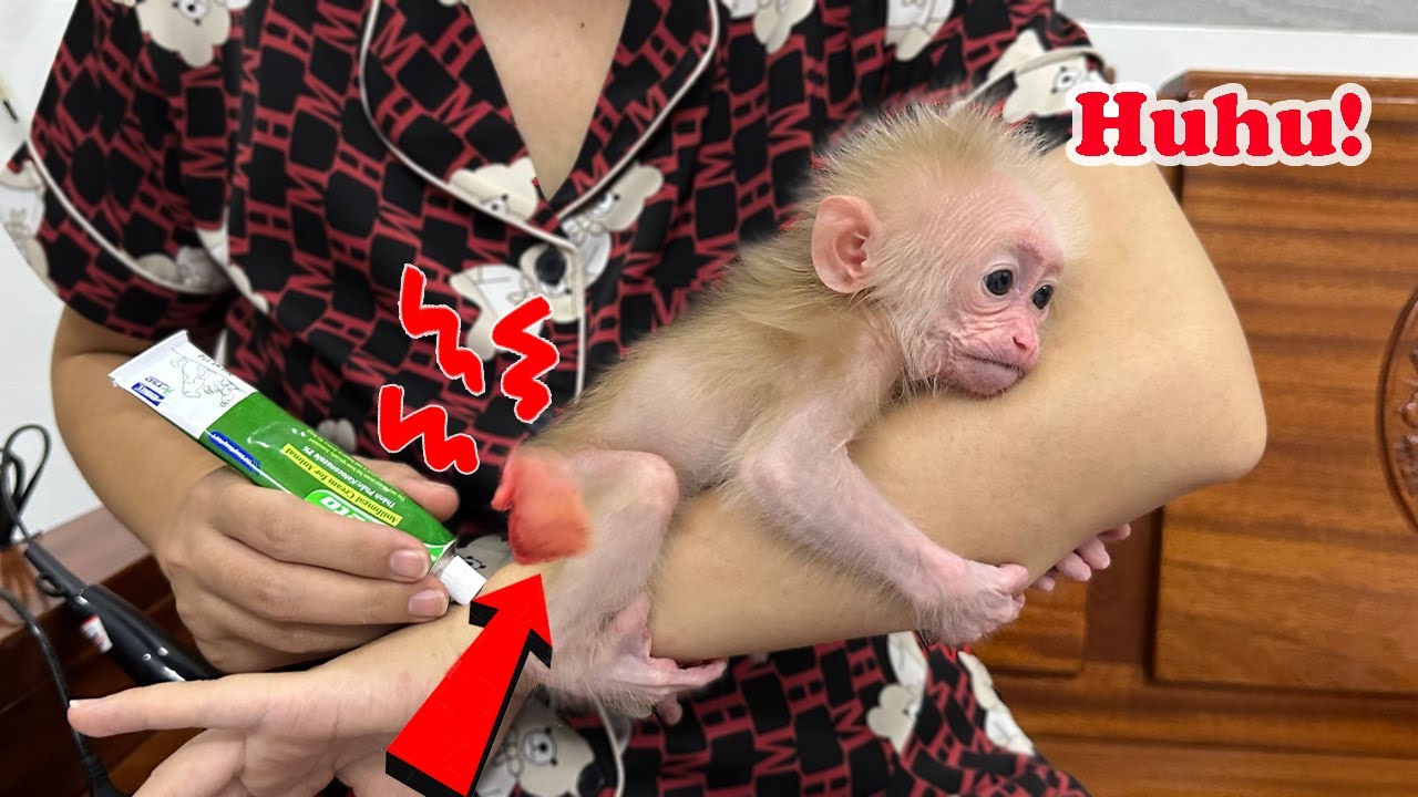 🔥What Happens When Sunny Gets Diaper Rash Here's How Mom Takes Care of Sunny