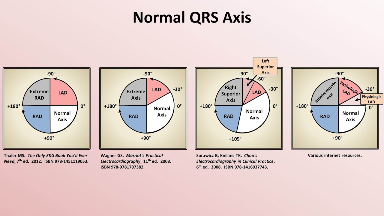 Intro to EKG Interpretation - Rate and Axis