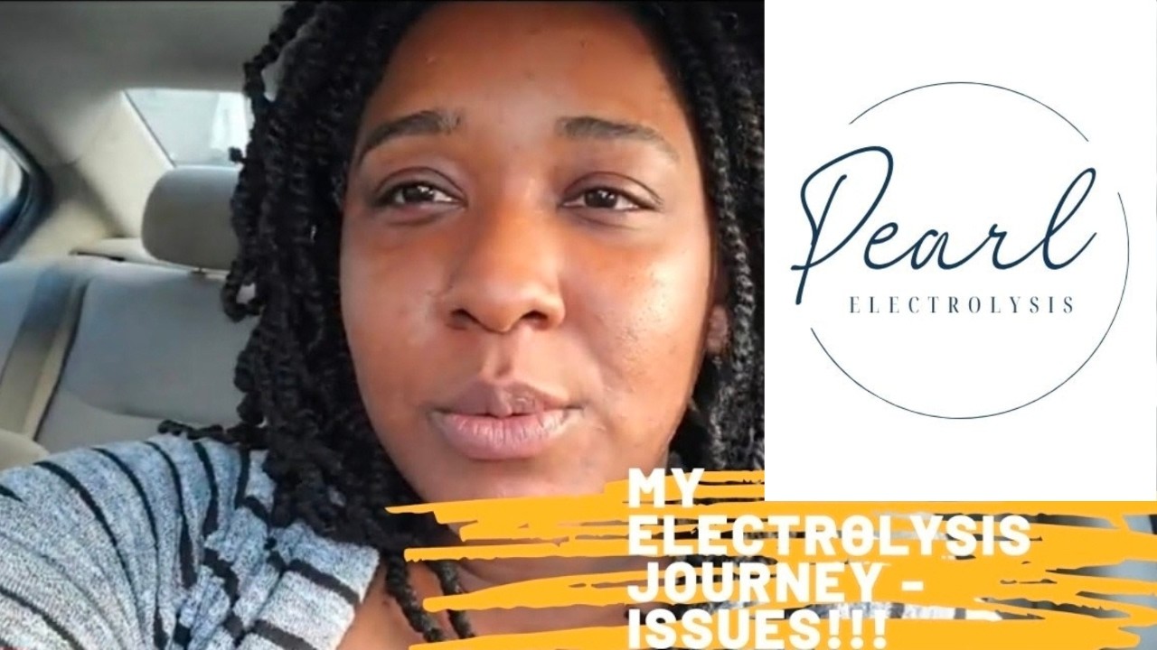 Electrolysis Update: What I've been dealing with 😳